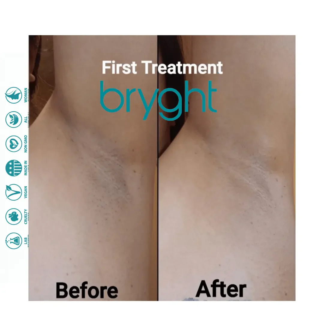 Before and after underarm skin tone transformation achieved through Bryght Brightening Treatment.