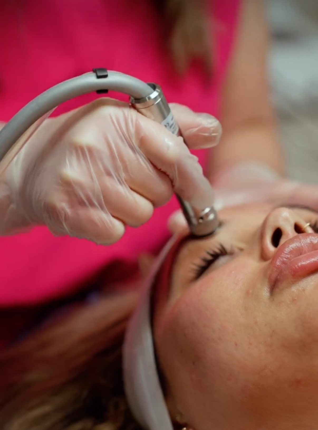 Close-up of a Hydrabrasion treatment.