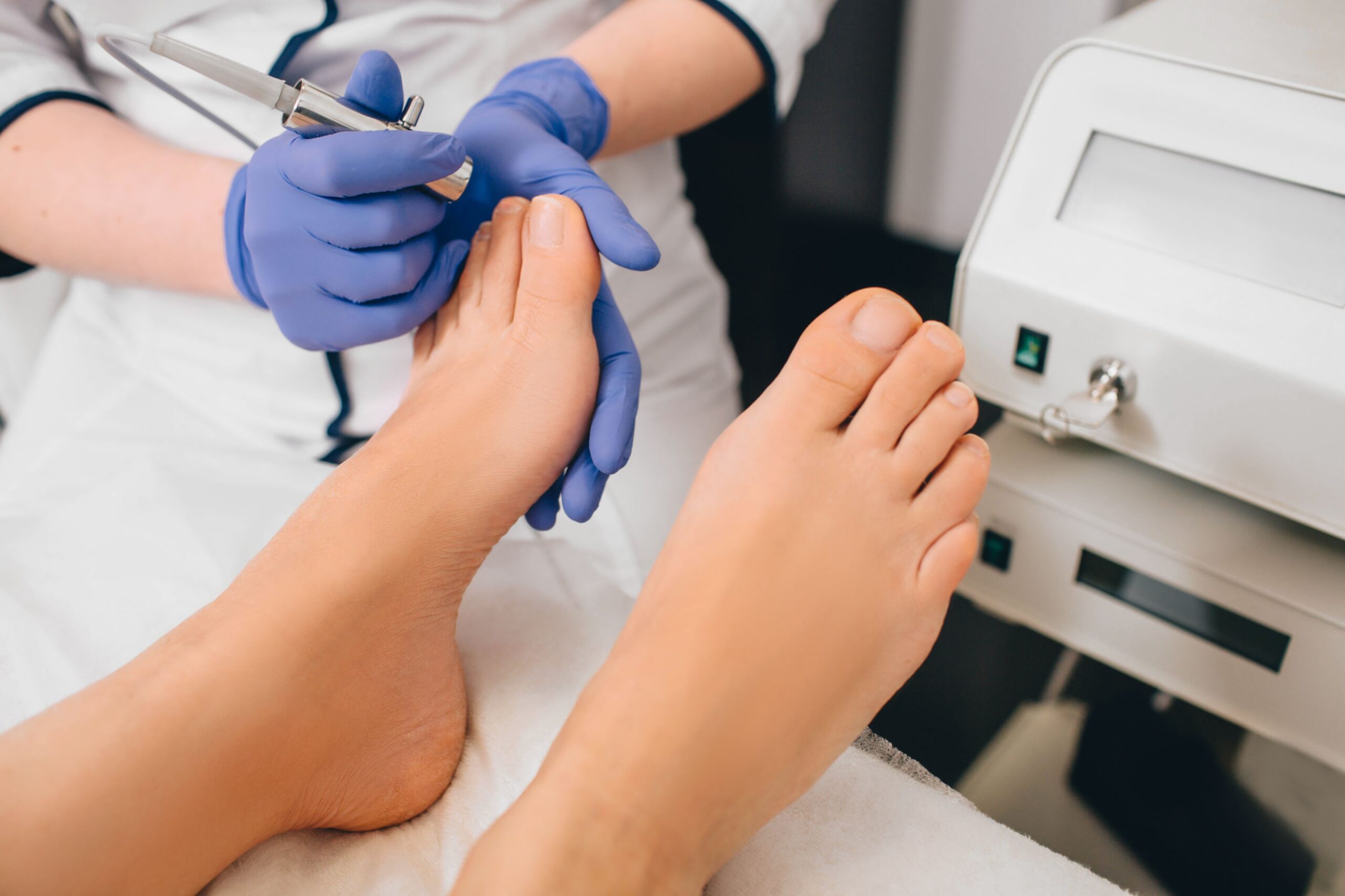 Close-up of a professional performing Nail Fungus Treatment using advanced equipment on a patient's foot.