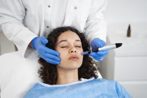 patient undergoing microneedling procedure (1)